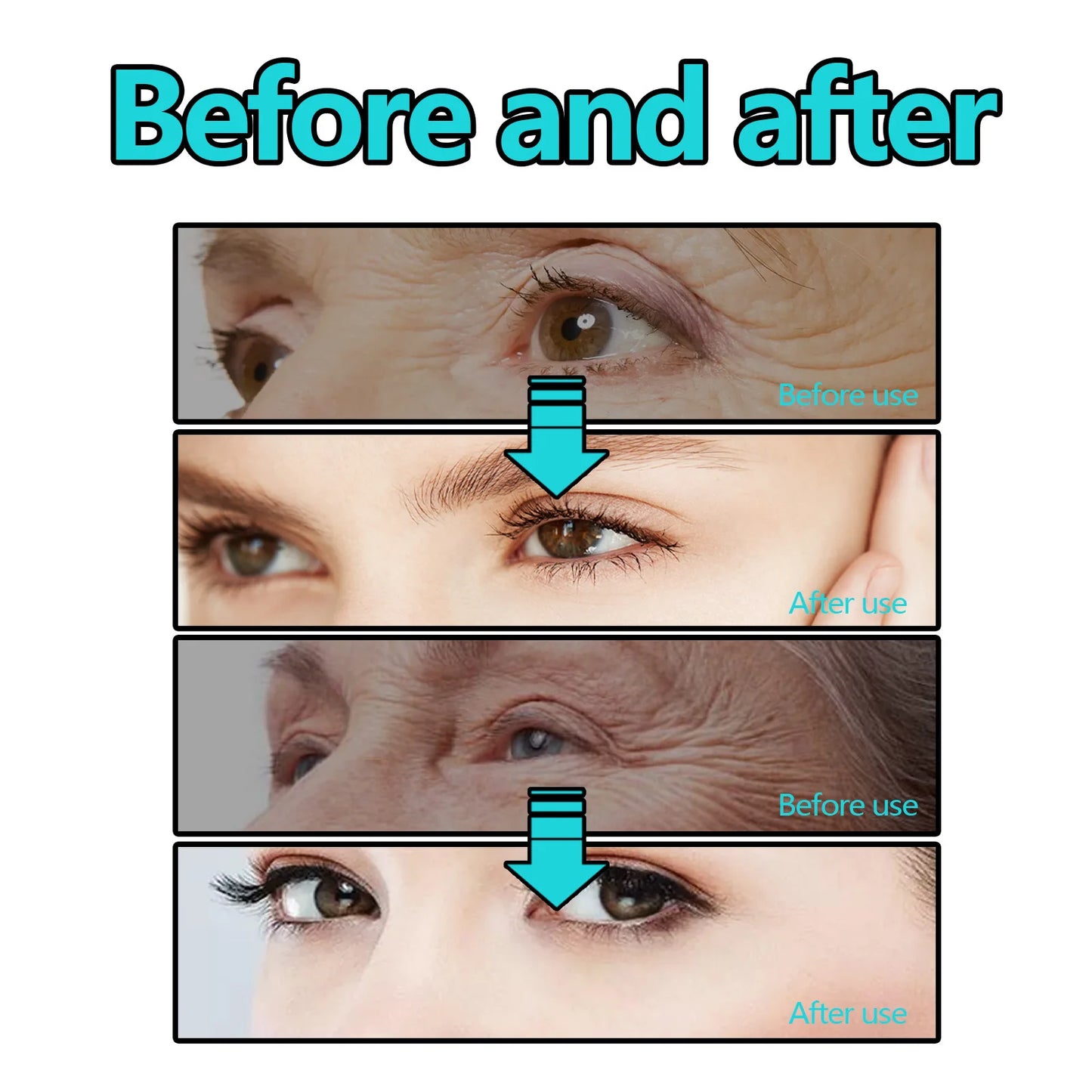 Hoygi Anti-Aging Eye Cream – Dark Circle, Puffiness & Fine Line Treatment, 15ml