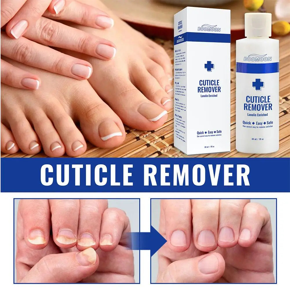 30ml Cuticle Remover Gel – Moisturizing Lanolin Enriched Nail & Toe Care