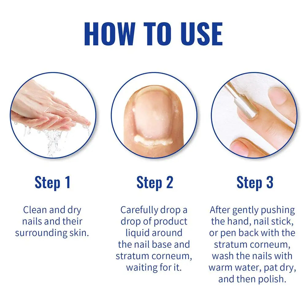 30ml Cuticle Remover Gel – Moisturizing Lanolin Enriched Nail & Toe Care