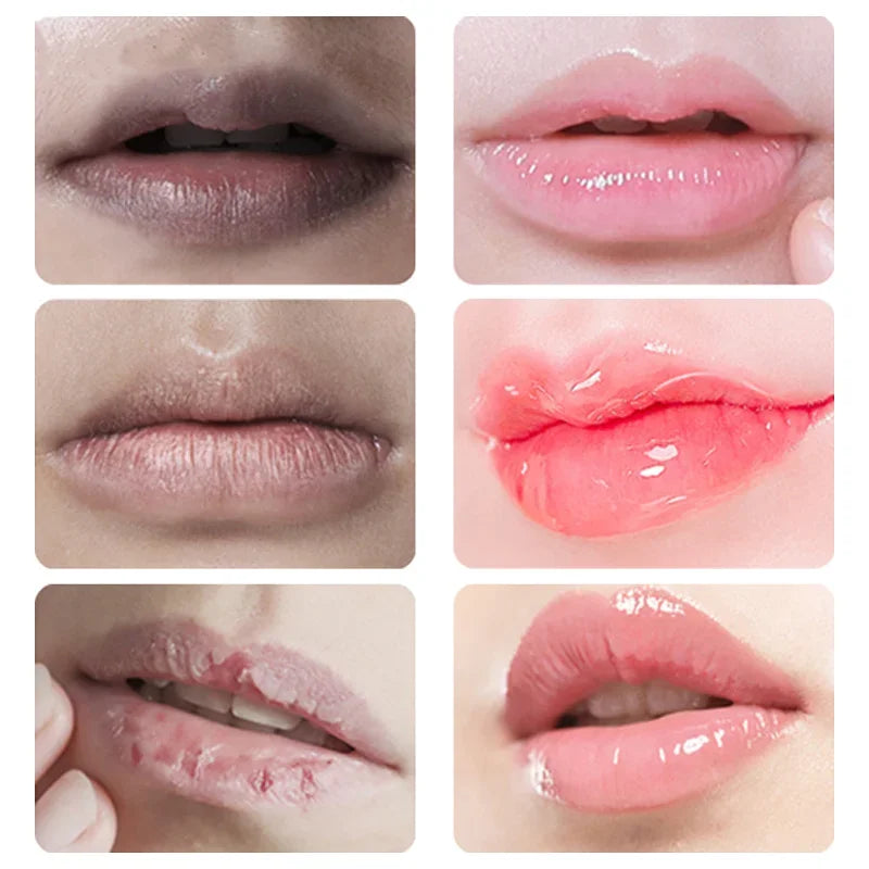 Dark Lip Balm Lightening & Exfoliating Lip Treatment - Collagen Hydrating Lip Mask for Moisturizing & Smooth Lips