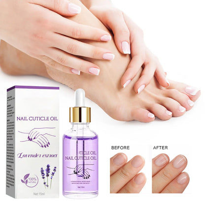 Nail Strengthening Cuticle Oil - Repair & Nourish Onychomycosis Treatment (15ml)
