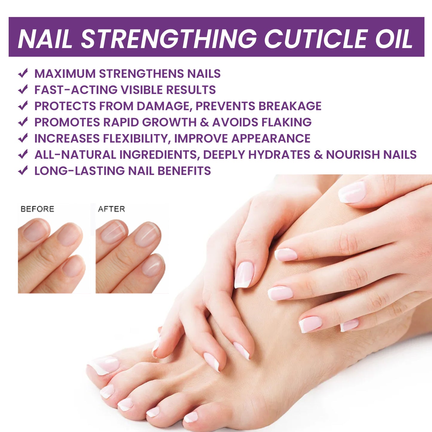 Nail Strengthening Cuticle Oil - Repair & Nourish Onychomycosis Treatment (15ml)