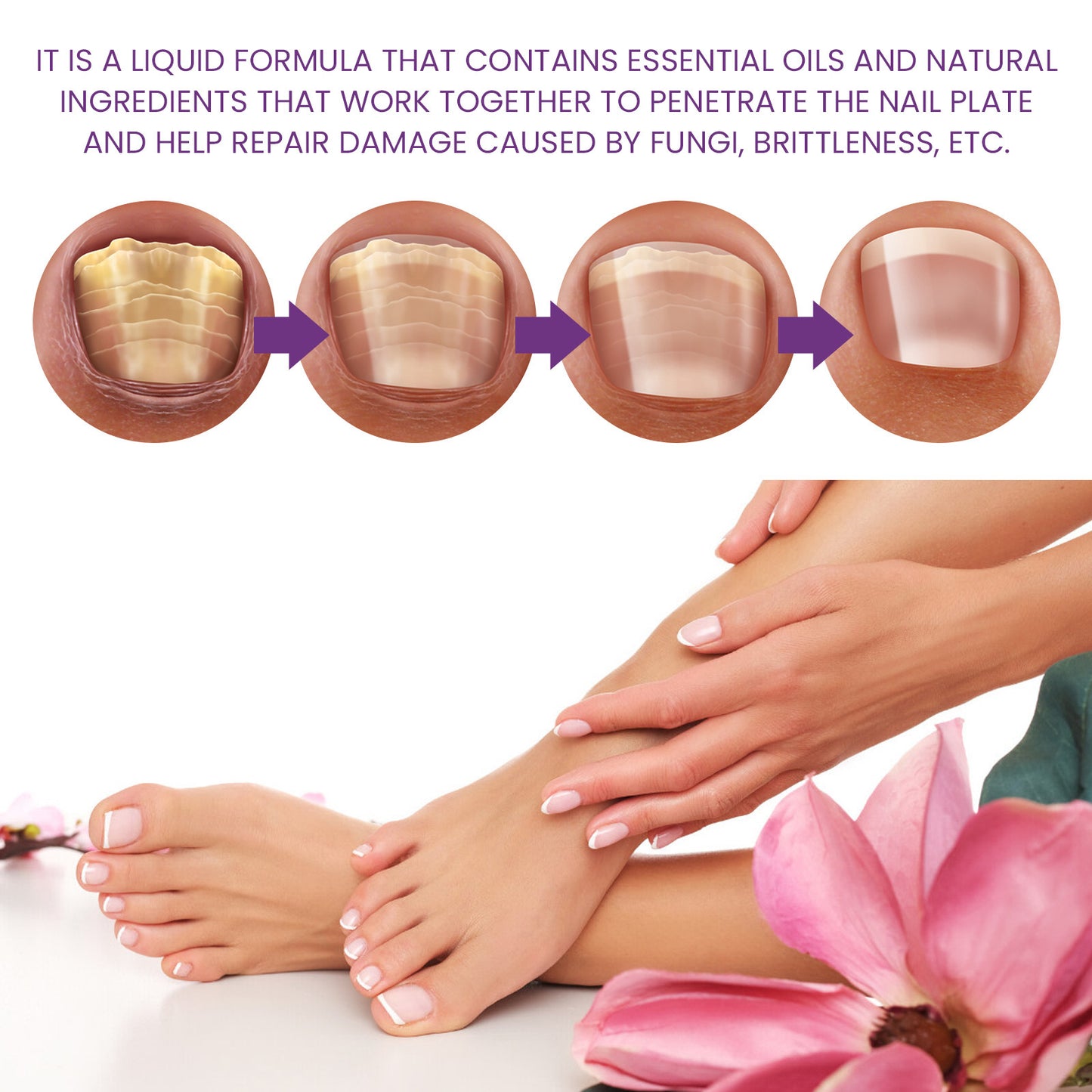 Nail Strengthening Cuticle Oil - Repair & Nourish Onychomycosis Treatment (15ml)