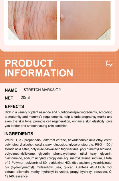 Stretch Marks Desalinate Essential Oil – Skin Care Cream for Maternity and Stretch Mark Treatment (20ml)