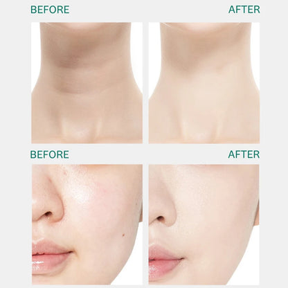 Multi-Functional Anti-Wrinkle Skin Rejuvenation Device - Neck, Face & Eye Lifting Massage Machine