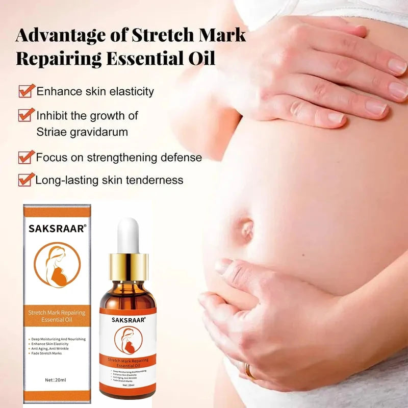 Stretch Marks Desalinate Essential Oil – Skin Care Cream for Maternity and Stretch Mark Treatment (20ml)