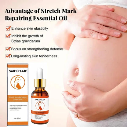 Stretch Marks Desalinate Essential Oil – Skin Care Cream for Maternity and Stretch Mark Treatment (20ml)