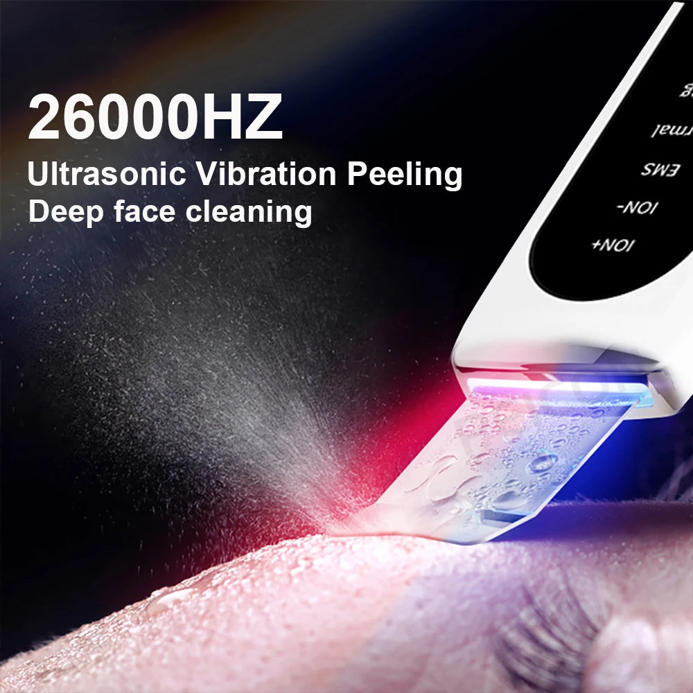 Ultrasonic Skin Scrubber - Blackhead Remover, Peeling & Pore Cleaner with Ion & Vibration Massage