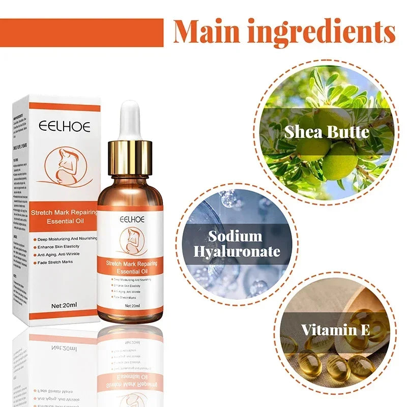 Stretch Mark Remover Essential Oil Treatment – Firming & Repairing Maternity Skin Care Cream (20ml)
