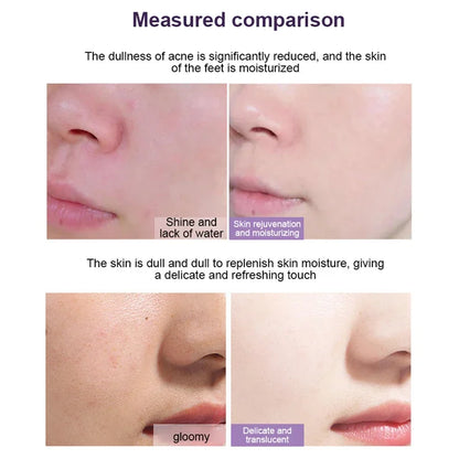 Hot Green Tea Solid Cleansing Mask – Acne, Blackhead Removal & Hydrating Face Mask