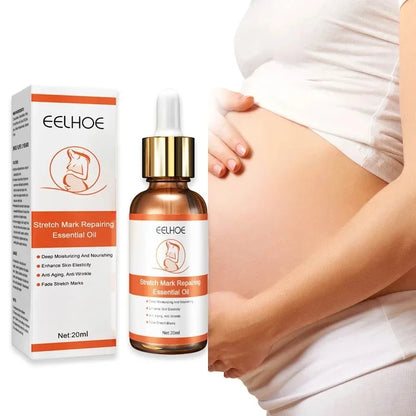 Stretch Mark Remover Essential Oil Treatment – Firming & Repairing Maternity Skin Care Cream (20ml)