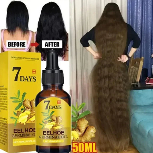 Ginger Hair Growth Serum - Anti-Hair Loss & Baldness Treatment - Fast Regrowth Hair Care Oil for Men & Women