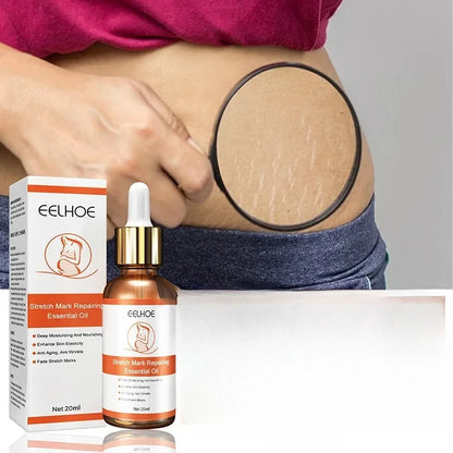 Stretch Mark Remover Essential Oil Treatment – Firming & Repairing Maternity Skin Care Cream (20ml)