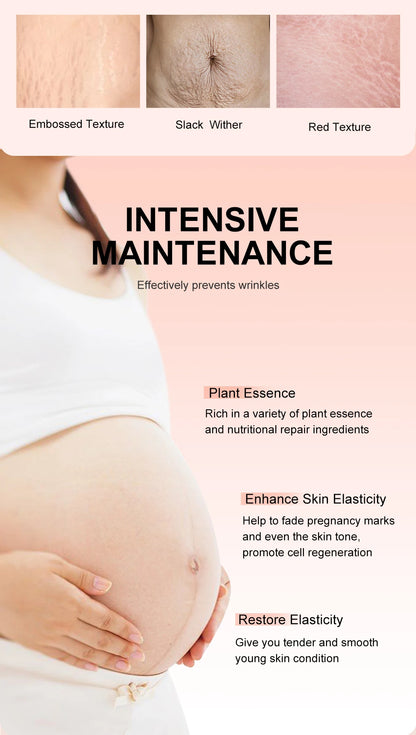 Stretch Marks Desalinate Essential Oil – Skin Care Cream for Maternity and Stretch Mark Treatment (20ml)