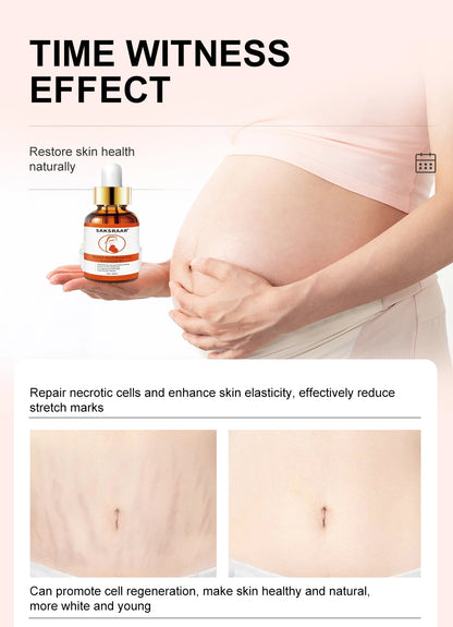 Stretch Marks Desalinate Essential Oil – Skin Care Cream for Maternity and Stretch Mark Treatment (20ml)