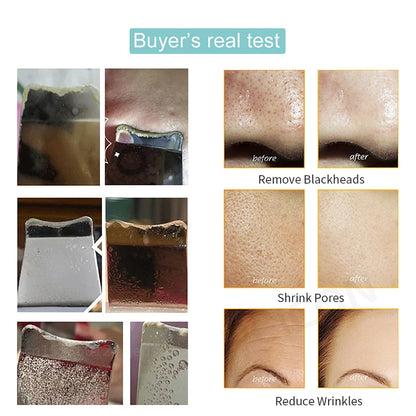 Ultrasonic Skin Scrubber - Blackhead Remover, Peeling & Pore Cleaner with Ion & Vibration Massage