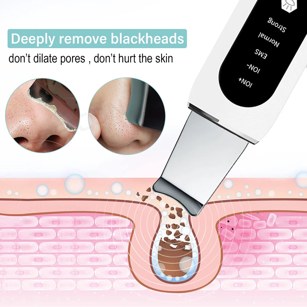 Ultrasonic Skin Scrubber - Blackhead Remover, Peeling & Pore Cleaner with Ion & Vibration Massage