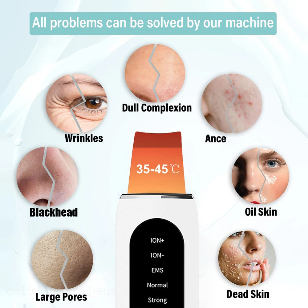 Ultrasonic Skin Scrubber - Blackhead Remover, Peeling & Pore Cleaner with Ion & Vibration Massage