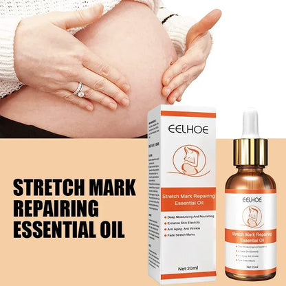 Stretch Mark Remover Essential Oil Treatment – Firming & Repairing Maternity Skin Care Cream (20ml)