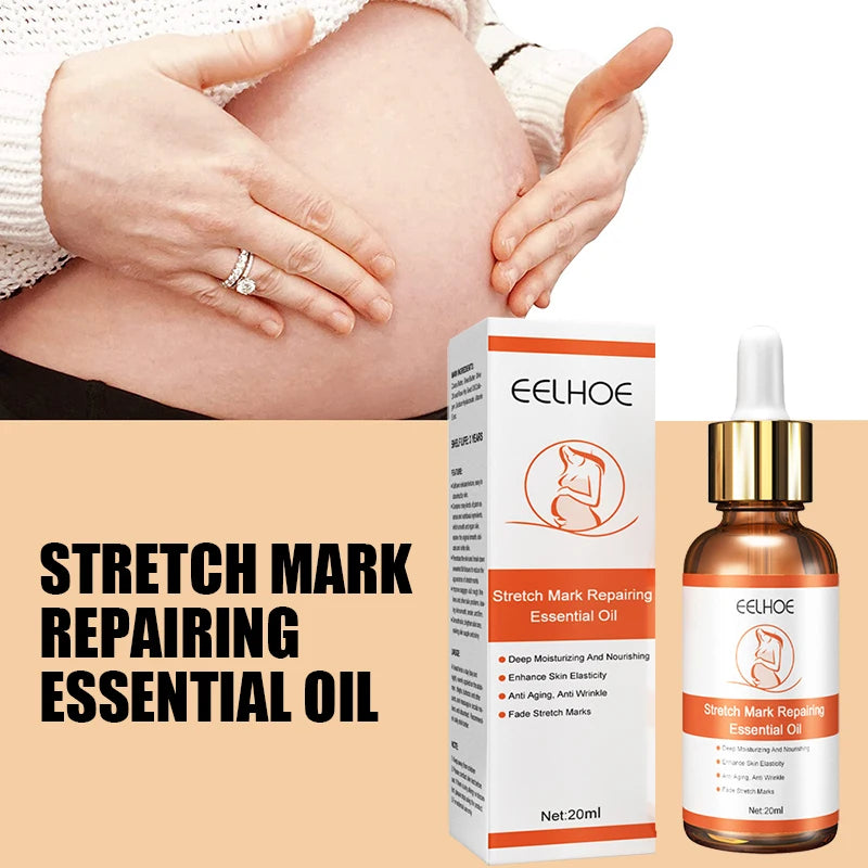 Stretch Mark Remover Essential Oil Treatment – Firming & Repairing Maternity Skin Care Cream (20ml)