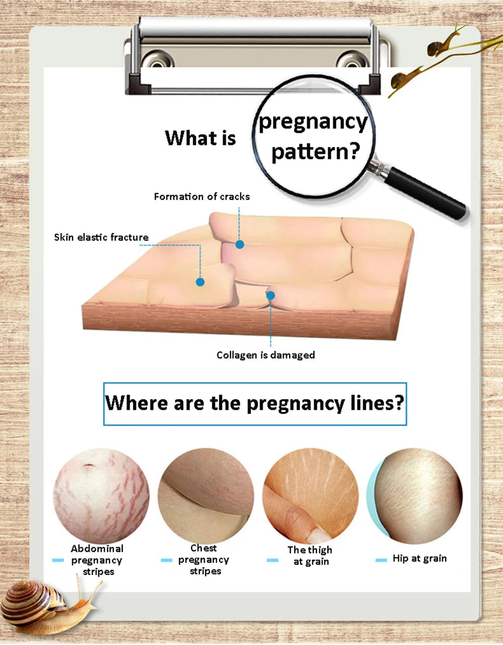 Stretch Mark Remover Essential Oil Treatment – Firming & Repairing Maternity Skin Care Cream (20ml)