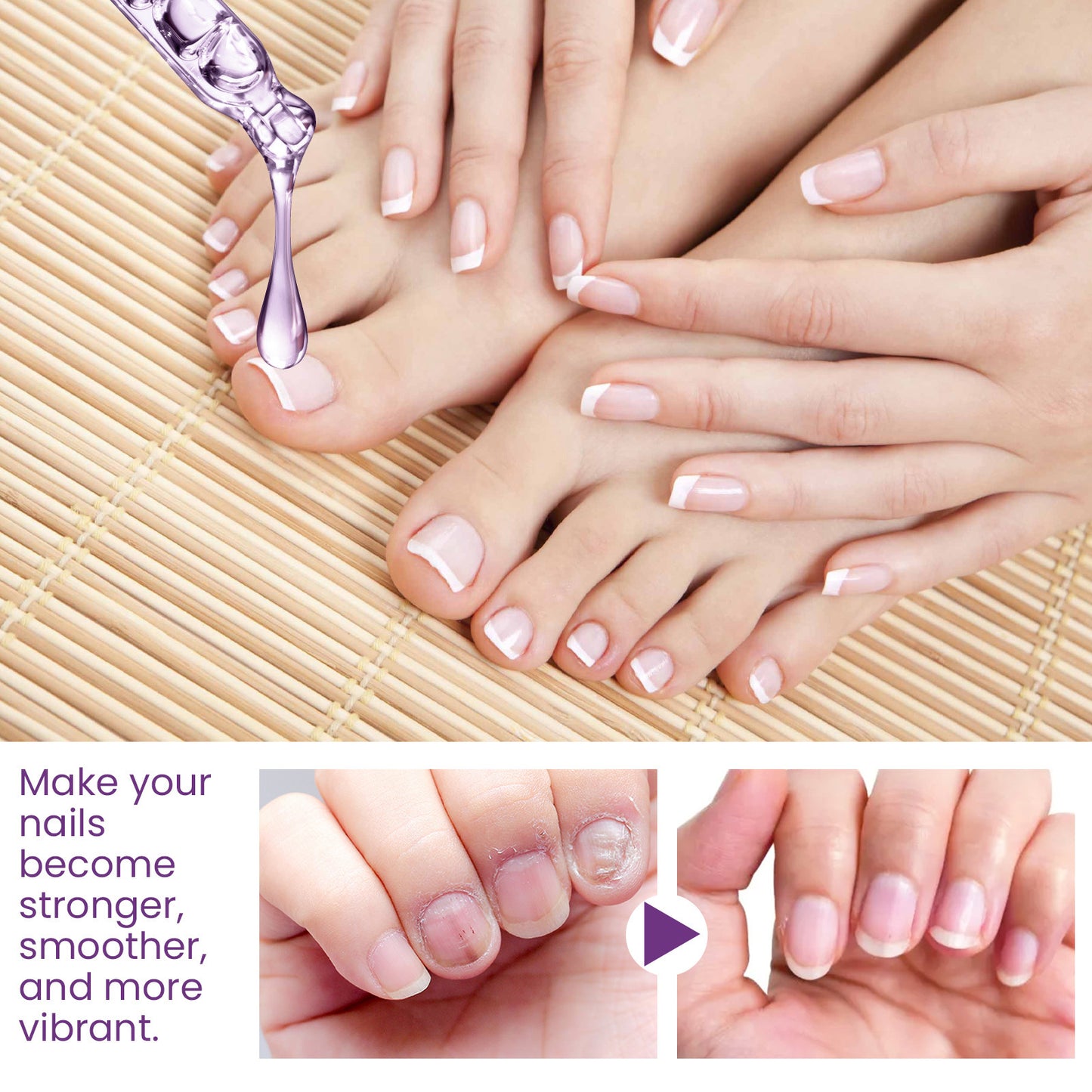 Nail Strengthening Cuticle Oil - Repair & Nourish Onychomycosis Treatment (15ml)