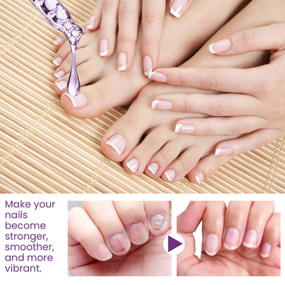 Nail Strengthening Cuticle Oil - Repair & Nourish Onychomycosis Treatment (15ml)