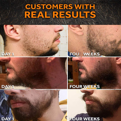 Beard Care Set – Cleaning & Nourishing Beard Kit with Turmeric & Apple Extract